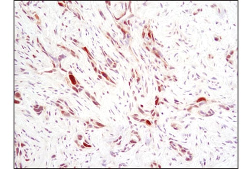 Immunohistochemistry Image 1: Phospho-Stat1 (Ser727) (D3B7) Rabbit mAb