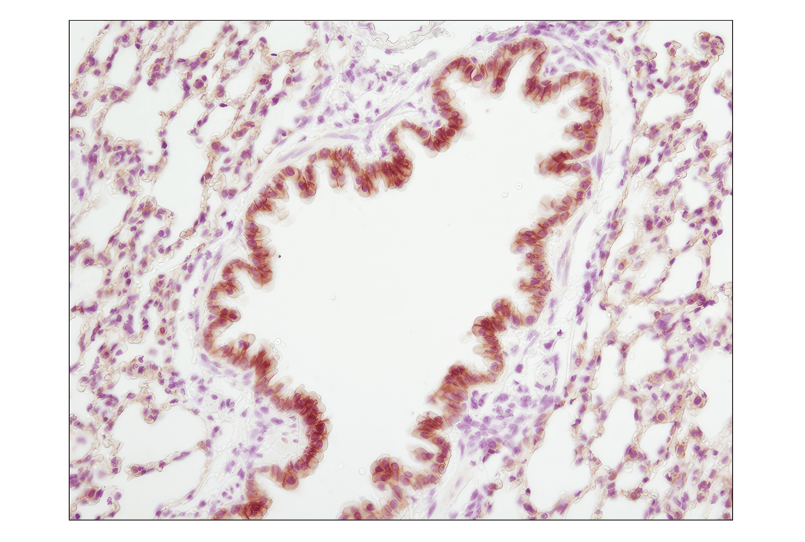 undefined Image 42: Cadherin-Catenin Antibody Sampler Kit