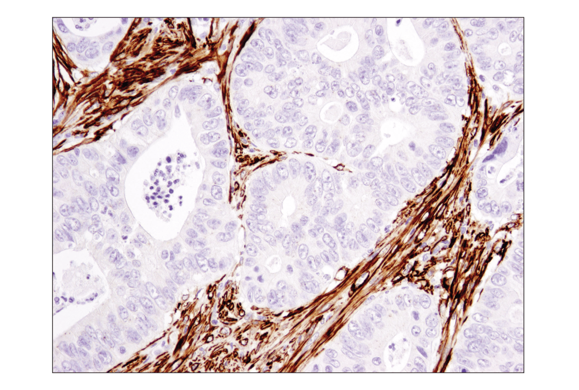 Immunohistochemistry Image 3: α-Smooth Muscle Actin (1A4) Mouse mAb (BSA and Azide Free)