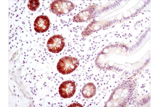 Immunohistochemistry Image 1: CA9 (D47G3) Rabbit mAb