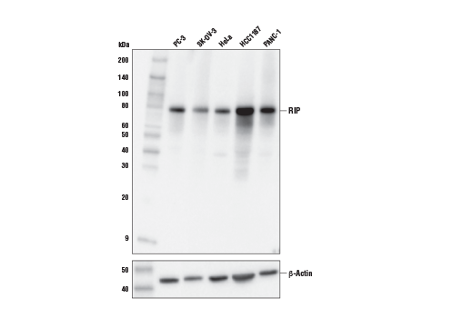 Western Blotting Image 2: RIP (E8S7U) XP<sup>®</sup> Rabbit mAb