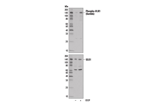 undefined Image 7: PhosphoPlus<sup>®</sup> ULK1 (Ser555) Antibody Duet