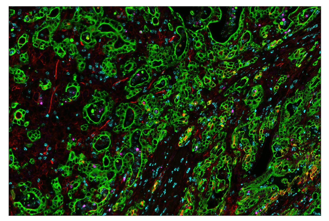 Immunohistochemistry Image 1: Phospho-Histone H2A.X (Ser139) (D7T2V) & CO-0135-647 SignalStar<sup>™</sup> Oligo-Antibody Pair
