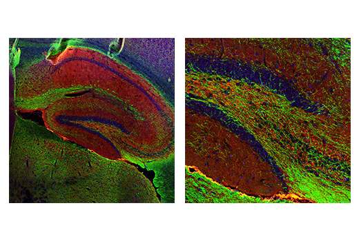 undefined Image 24: Demyelinating Disease Targets Antibody Sampler Kit