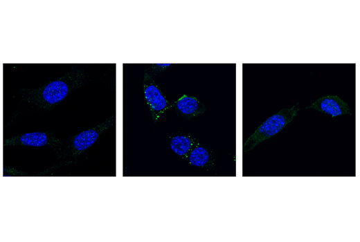 undefined Image 18: Mouse Reactive Cell Death and Autophagy Antibody Sampler Kit