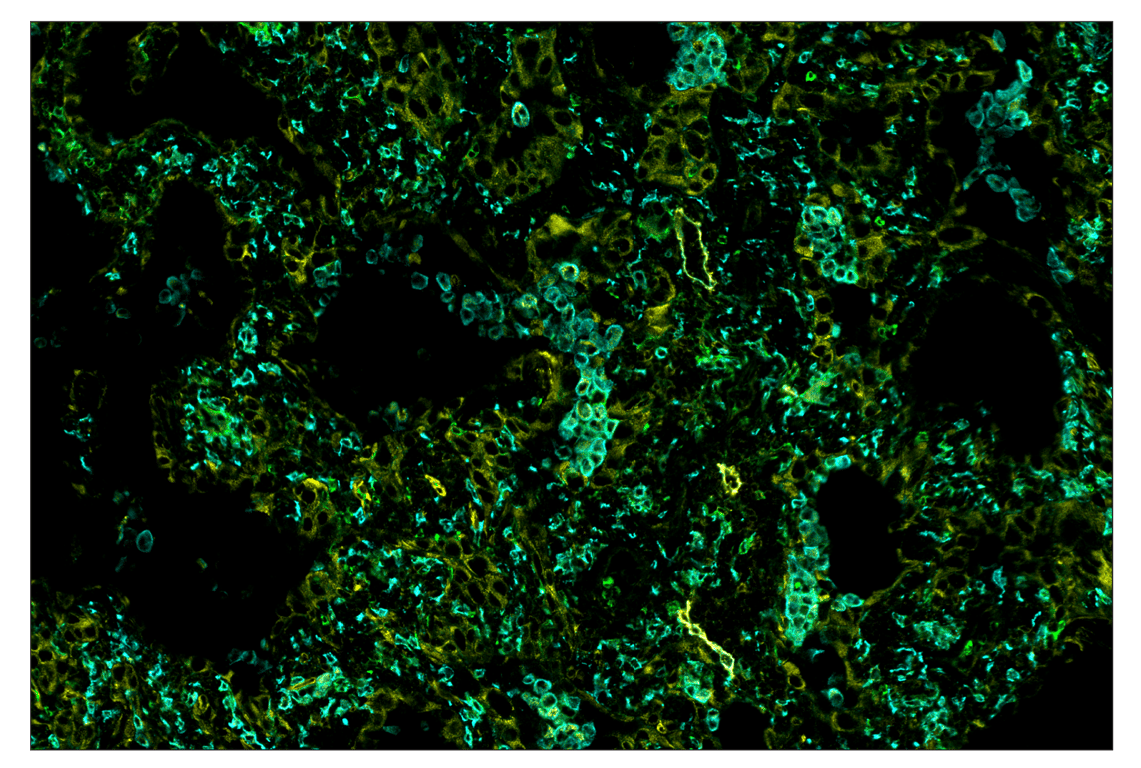 Immunohistochemistry Image 7: CD11b/ITGAM (D6X1N) & CO-0037-750 SignalStar<sup>™</sup> Oligo-Antibody Pair