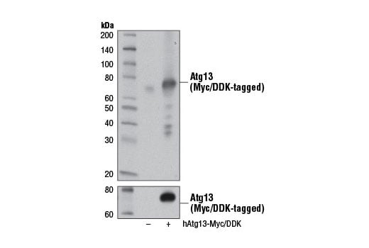 Western Blotting Image 2: Atg13 (D4P1K) Rabbit mAb