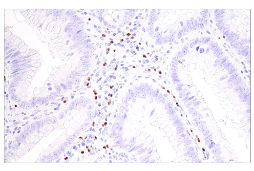 Immunohistochemistry Image 4: Olig2 (E6G6Q) XP<sup>®</sup> Rabbit mAb (BSA and Azide Free)