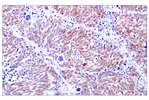 Immunohistochemistry Image 1: POU2F3 (E5N2D) XP<sup>®</sup> Rabbit mAb