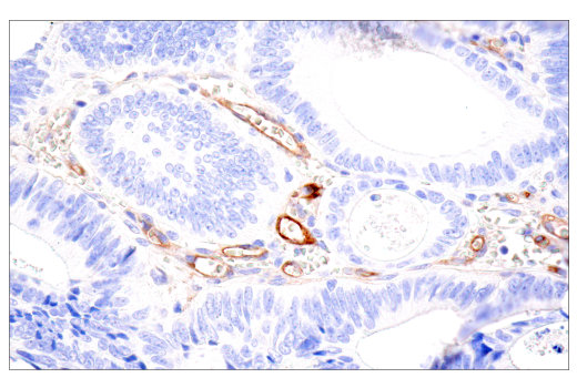 Immunohistochemistry Image 2: CD109 (E4I2V) Rabbit mAb
