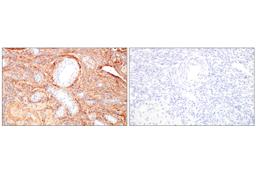 Immunohistochemistry Image 9: COL14A1 (E5W8S) Rabbit mAb (BSA and Azide Free)