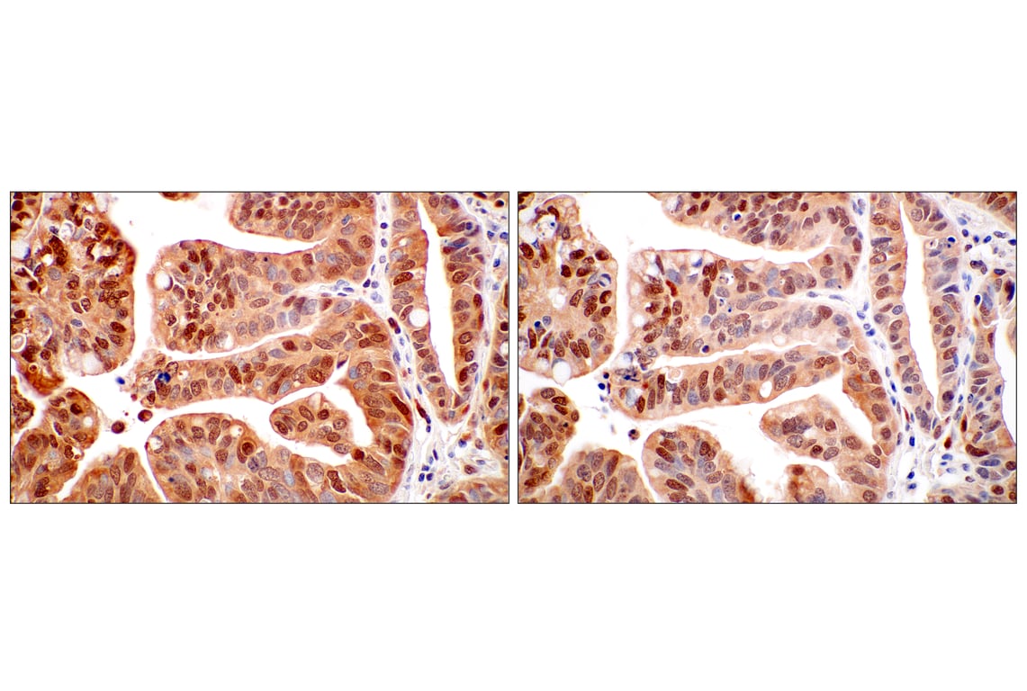 Immunohistochemistry Image 8: SerpinB1 (E4W7B) Rabbit mAb