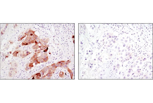 Immunohistochemistry Image 1: Phospho-Stathmin (Ser38) (D19H10) Rabbit mAb