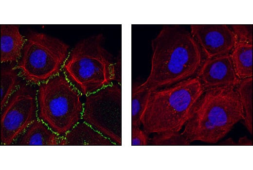 Immunofluorescence Image 2: P-Cadherin Antibody