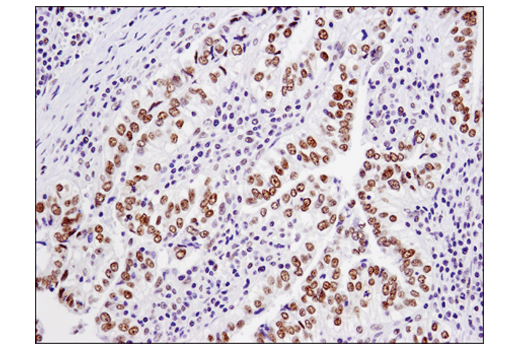 Immunohistochemistry Image 2: TRIM33 (D7U4F) Rabbit mAb