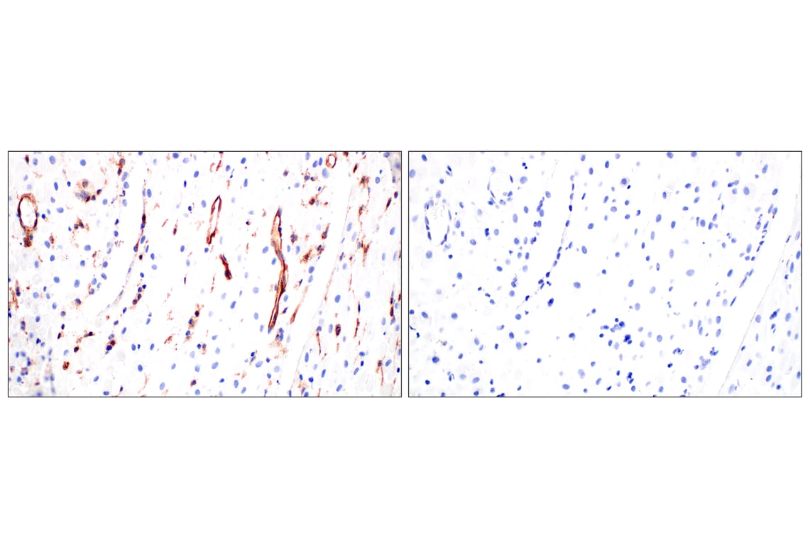 Immunohistochemistry Image 8: CD93/C1qR (E5H9B) Rabbit mAb (BSA and Azide Free)