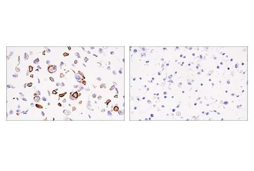 Immunohistochemistry Image 5: Keratin 5 (E2T4B) XP<sup>®</sup> Rabbit mAb