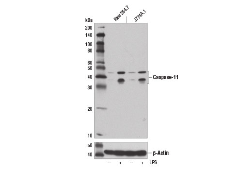 undefined Image 4: Mouse Reactive Pyroptosis Antibody Sampler Kit