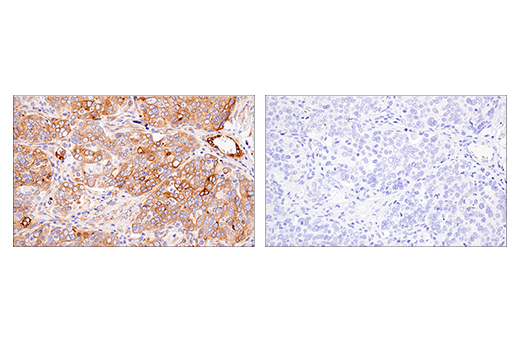Immunohistochemistry Image 4: APP (E8B3O) XP<sup>®</sup> Rabbit mAb