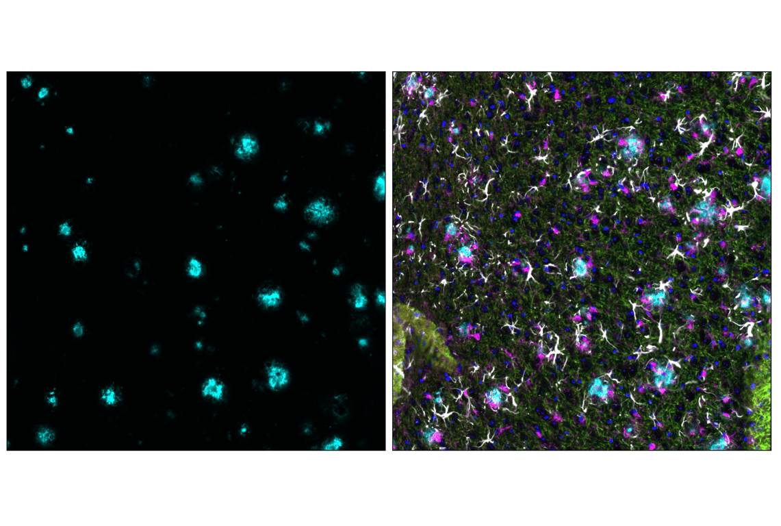 Immunofluorescence Image 3: β-Amyloid (D54D2) XP<sup>®</sup> Rabbit mAb (Alexa Fluor<sup>®</sup> 488 Conjugate)