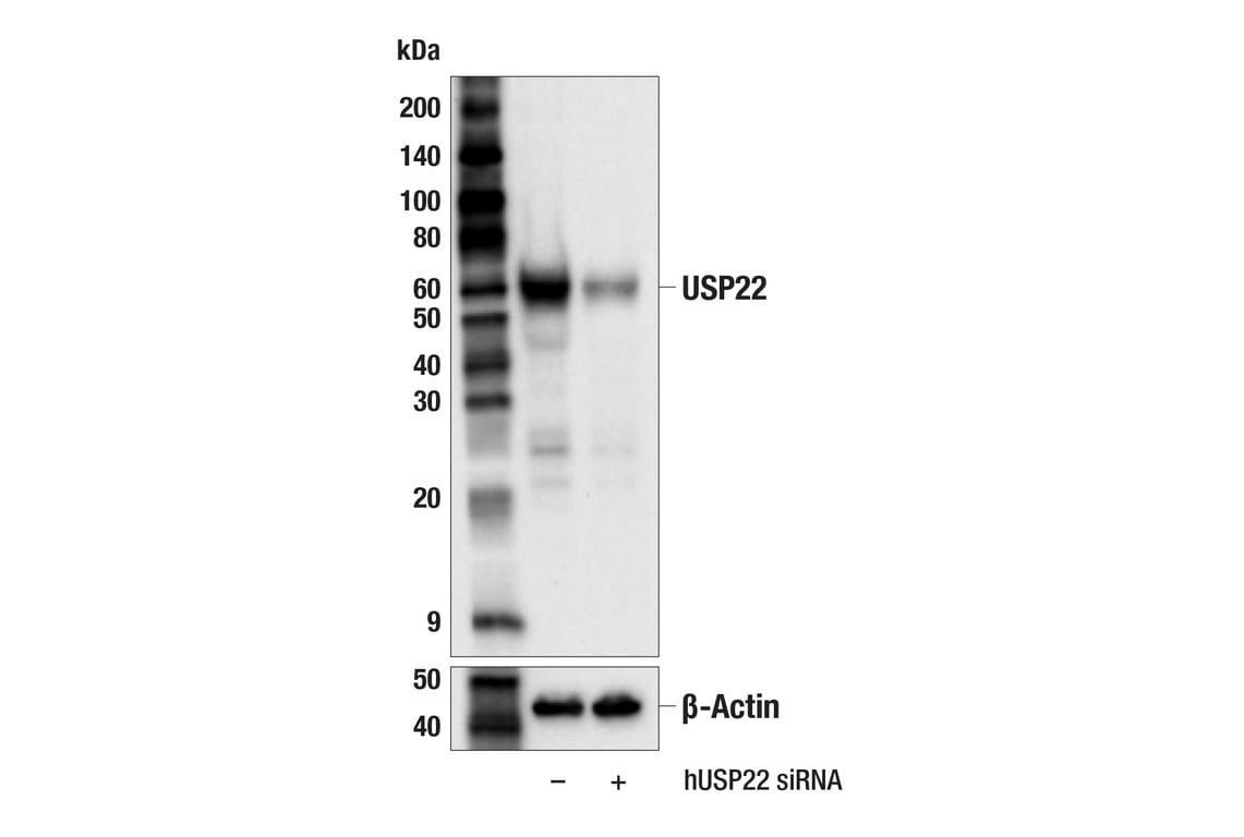 Western Blotting Image 2: USP22 (F4M4V) Rabbit mAb