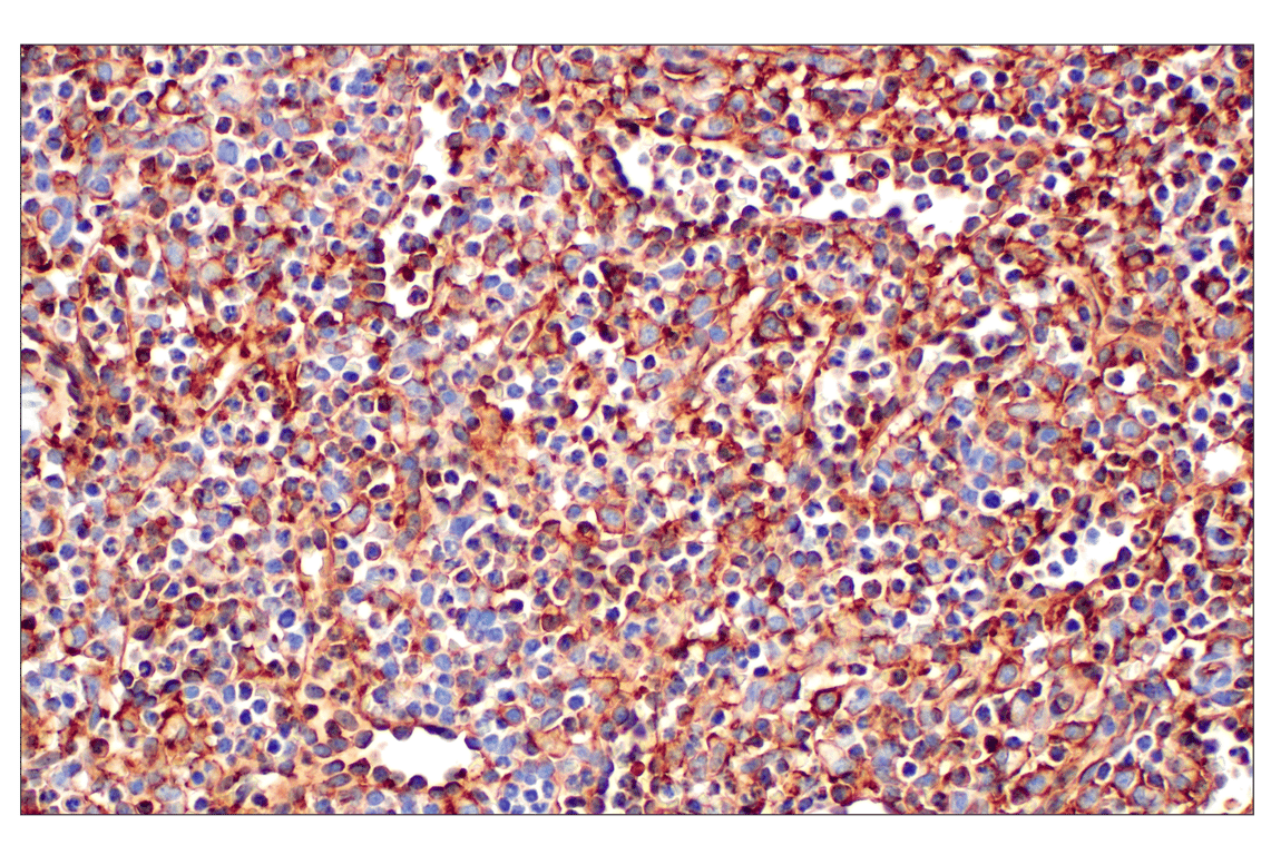 Immunohistochemistry Image 3: CD31 (PECAM-1) (F8M3S) Rabbit mAb (BSA and Azide Free)