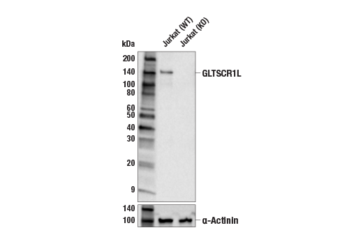 undefined Image 7: Non-Canonical BAF Complex Antibody Sampler Kit