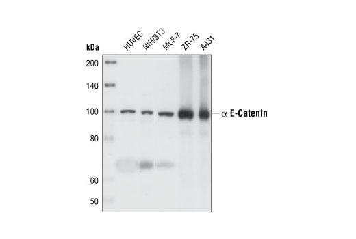 undefined Image 11: Cadherin-Catenin Antibody Sampler Kit