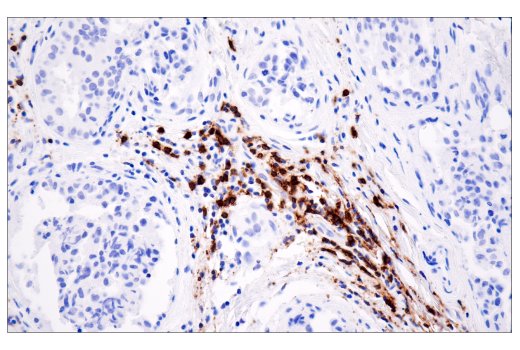 Immunohistochemistry Image 2: CD20 (E7B7T) XP<sup>®</sup> Rabbit mAb (BSA and Azide Free)
