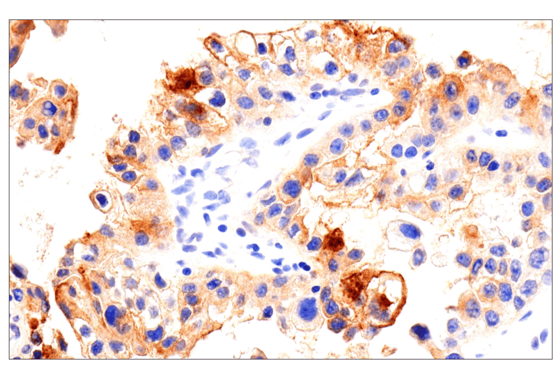 Immunohistochemistry Image 5: Folate Receptor Alpha/FOLR1 (BN3.2) Mouse mAb