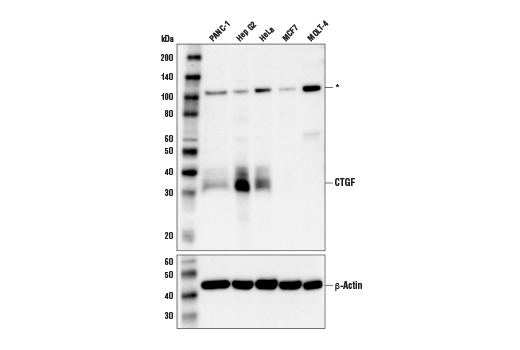 Western Blotting Image 1: CTGF (D8Z8U) Rabbit mAb (BSA and Azide Free)