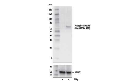 PhosphoPlus® SMAD2 (Ser465/467) Antibody Duet: Image 1
