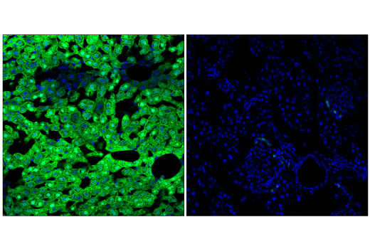 Immunofluorescence Image 2: Arginase-1 (D4E3M<sup>™</sup>) XP<sup>®</sup> Rabbit mAb (Alexa Fluor<sup>®</sup> 488 Conjugate)