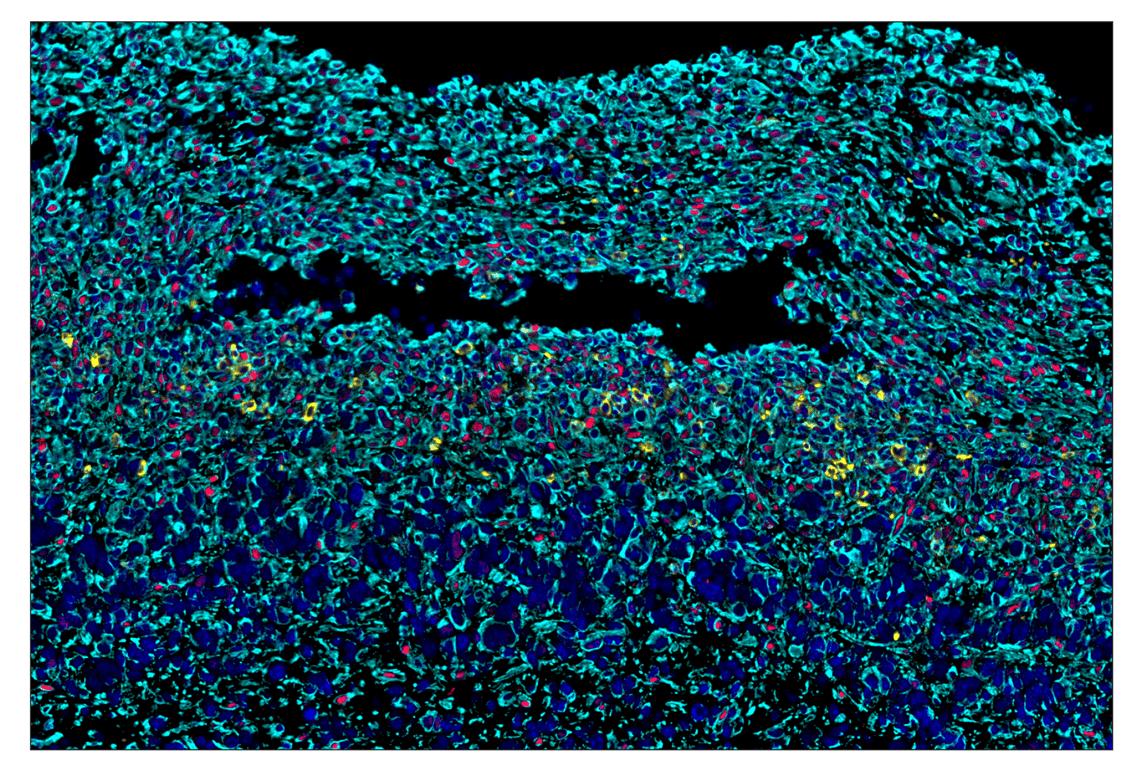 Immunohistochemistry Image 8: Vimentin (D21H3) & CO-0012-647 SignalStar<sup>™</sup> Oligo-Antibody Pair