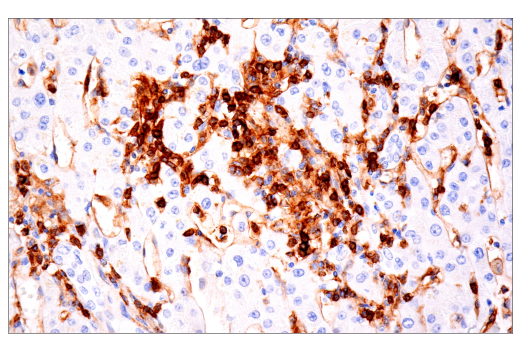 Immunohistochemistry Image 2: CD4 (EP204) Rabbit mAb