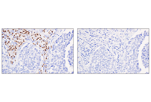 Immunohistochemistry Image 4: IRF-4 (E8H3S) XP<sup>®</sup> Rabbit mAb (BSA and Azide Free)