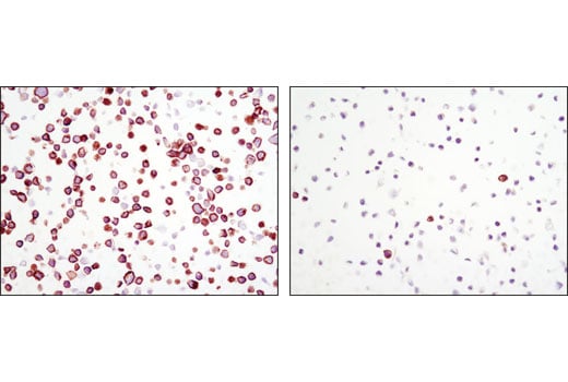 Immunohistochemistry Image 5: Phospho-Met (Tyr1234/1235) (D26) XP<sup>®</sup> Rabbit mAb (BSA and Azide Free)