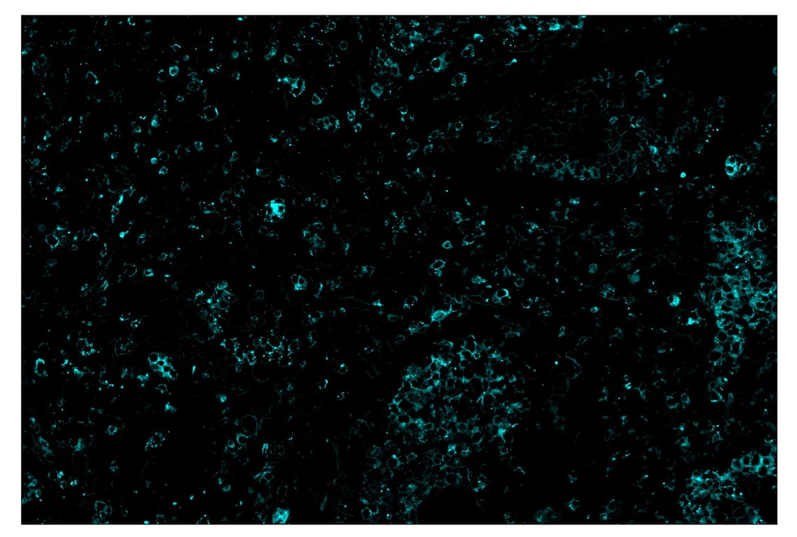 Immunohistochemistry Image 5: TIM-3 (D5D5R<sup>™</sup>) & CO-0010-647 SignalStar<sup>™</sup> Oligo-Antibody Pair