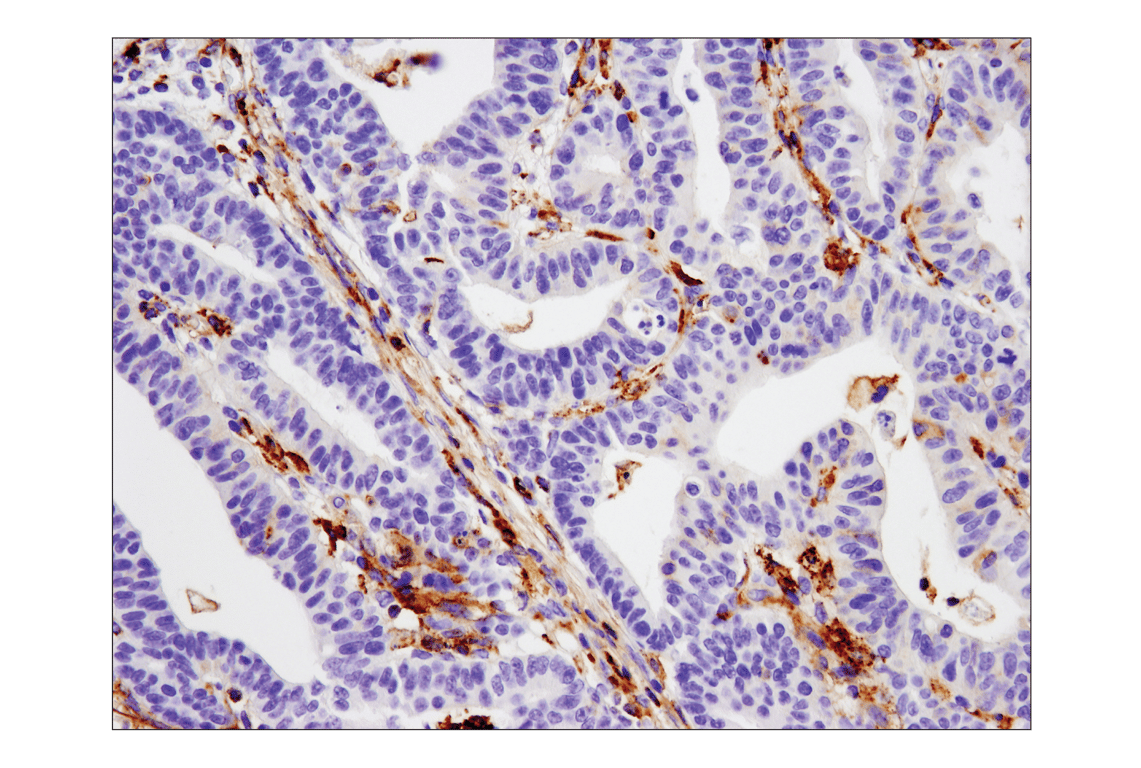 Immunohistochemistry Image 1: VISTA (D1L2G<sup>™</sup>) XP<sup>®</sup> Rabbit mAb