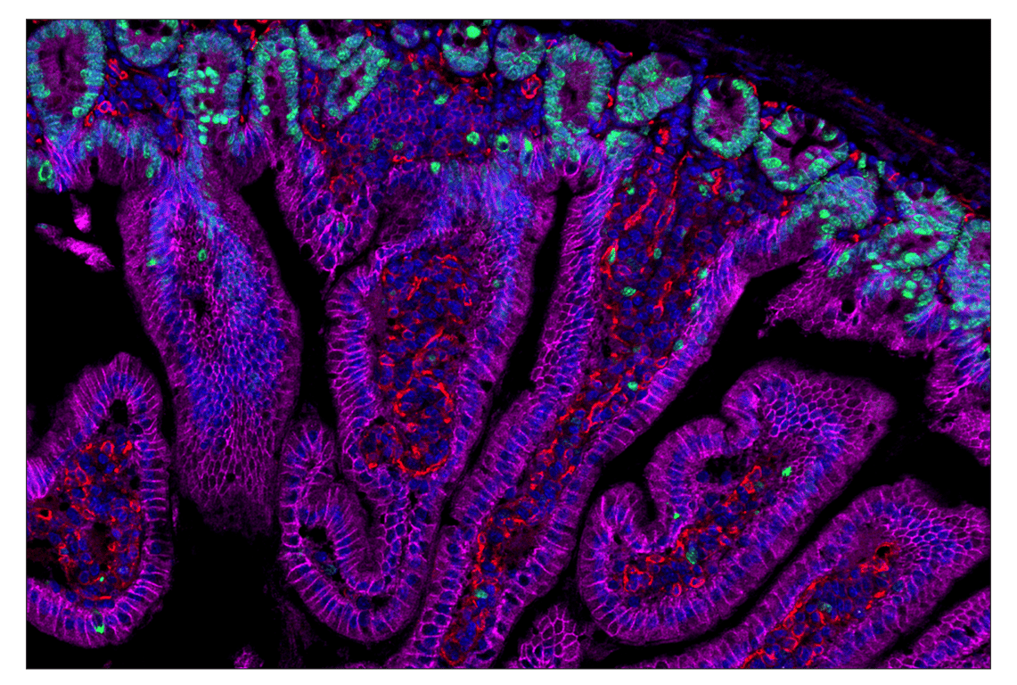 Immunohistochemistry Image 2: HER2/ErbB2 (D8F12) & CO-0059-488 SignalStar<sup>™</sup> Oligo-Antibody Pair