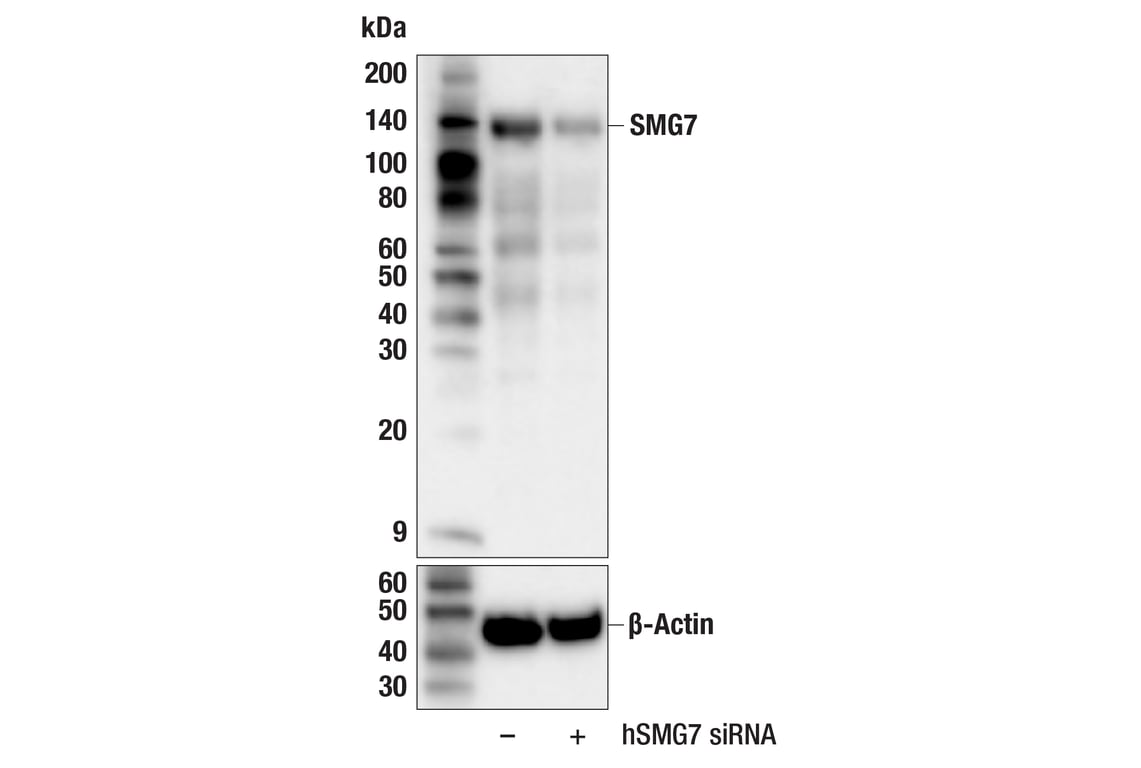 Western Blotting Image 2: SMG7 (F9W1J) Rabbit mAb
