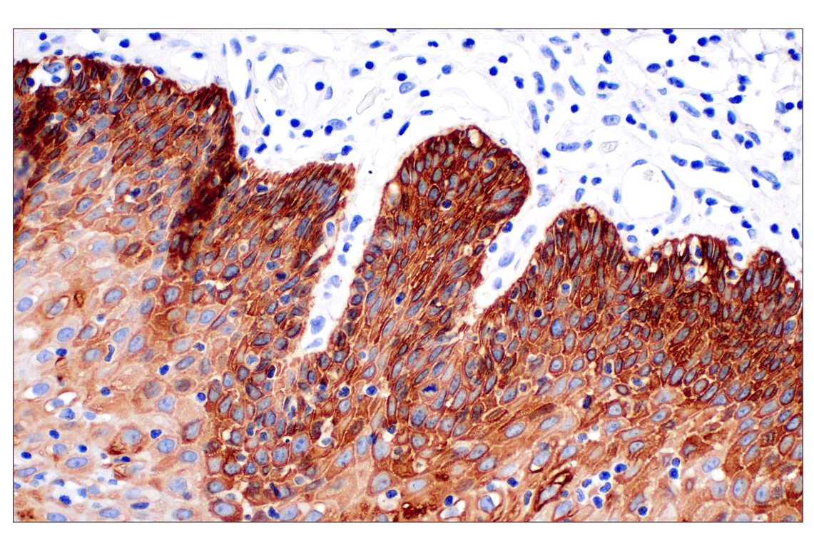 Immunohistochemistry Image 4: Keratin 14 (E7W6V) Rabbit mAb