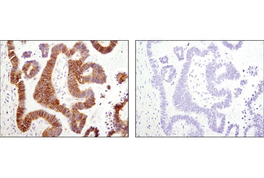 undefined Image 29: SARS-CoV-2 Virus-Host Interaction Antibody Sampler Kit