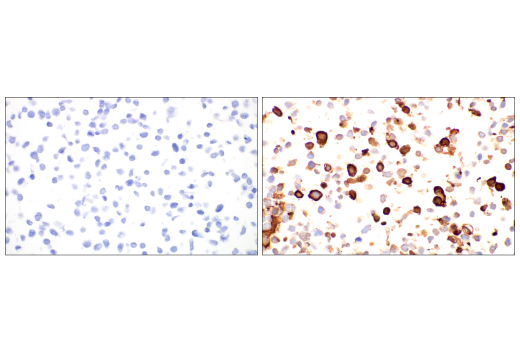 Immunohistochemistry Image 4: SARS-CoV-2 Nucleocapsid Protein (E9L7H) XP<sup>®</sup> Rabbit mAb