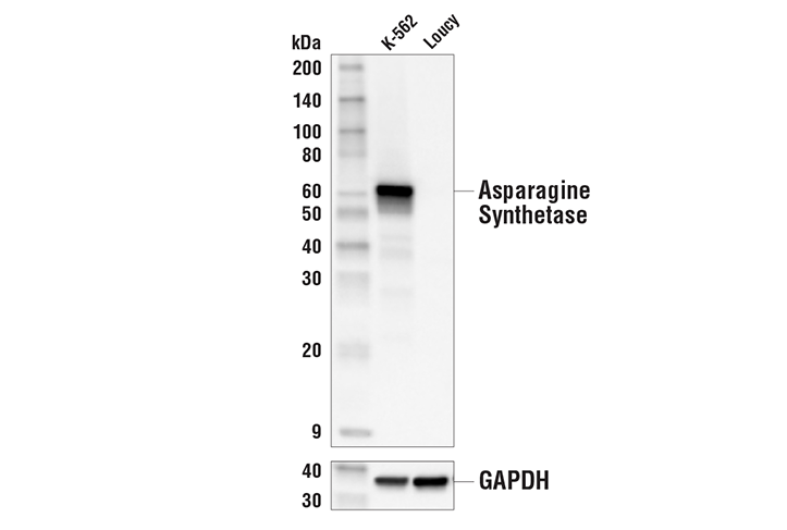 Western Blotting Image 1: Asparagine Synthetase (E6C2C) XP<sup>®</sup> Rabbit mAb (BSA and Azide Free)