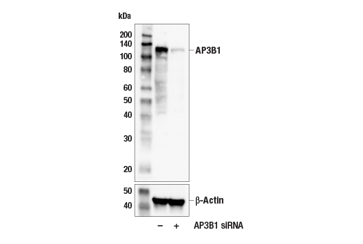 Western Blotting Image 2: AP3B1 (E7U2P) Rabbit mAb
