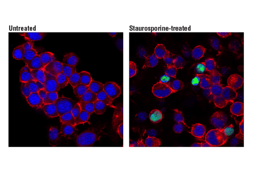 undefined Image 59: Tau Mouse Model Neuronal Viability IF Antibody Sampler Kit