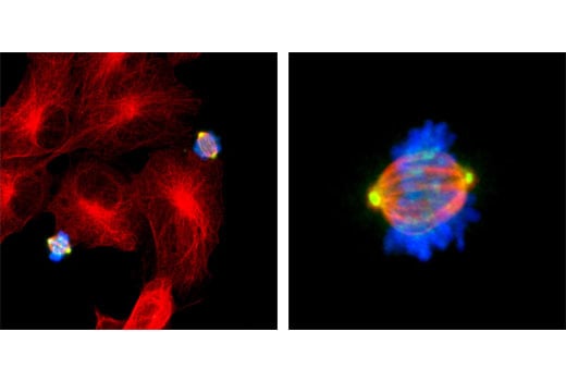 Immunofluorescence Image 1: Phospho-Aurora A (Thr288)/Aurora B (Thr232)/Aurora C (Thr198) (D13A11) XP<sup>®</sup> Rabbit mAb