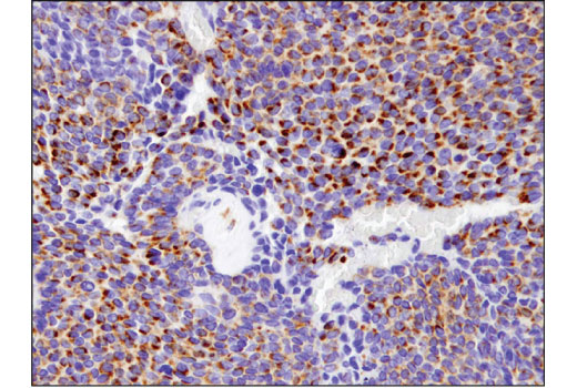 Immunohistochemistry Image 2: BNIP3 (D7U1T) Rabbit mAb