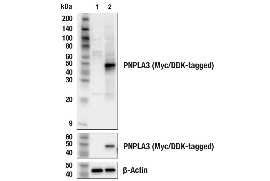 Western Blotting Image 1: PNPLA3 (E7N6O) Rabbit mAb